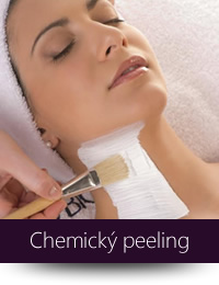Chemický peeling
